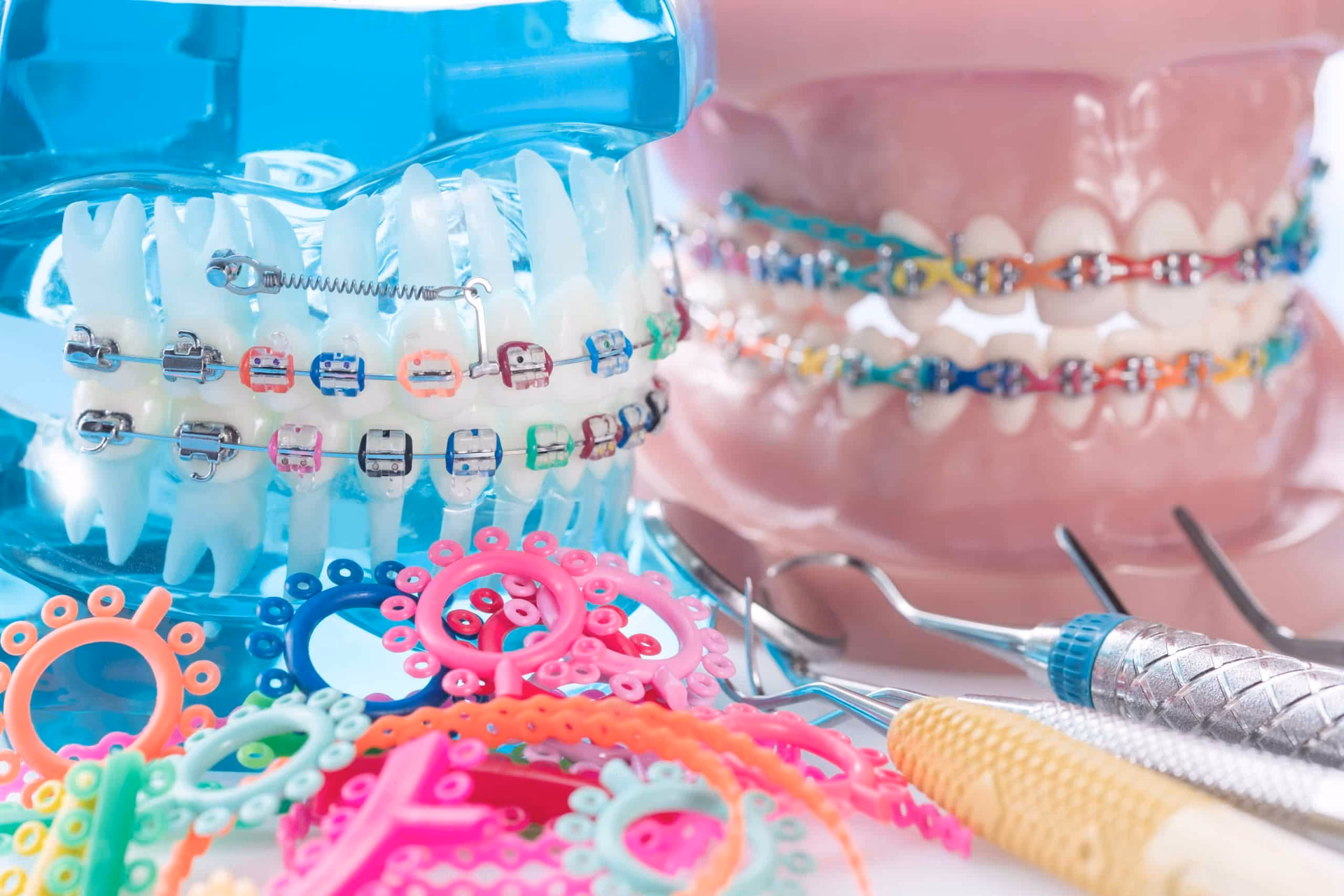 Który aparat na zęby jest lepszy?