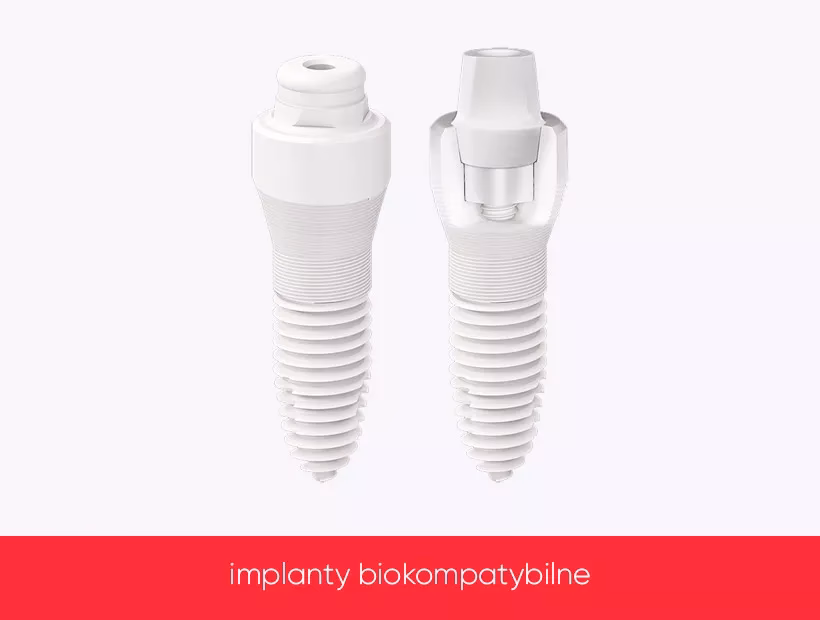 Dlaczego materiał ceramiczny nie jest dobrym wyborem na materiał implantologiczny?