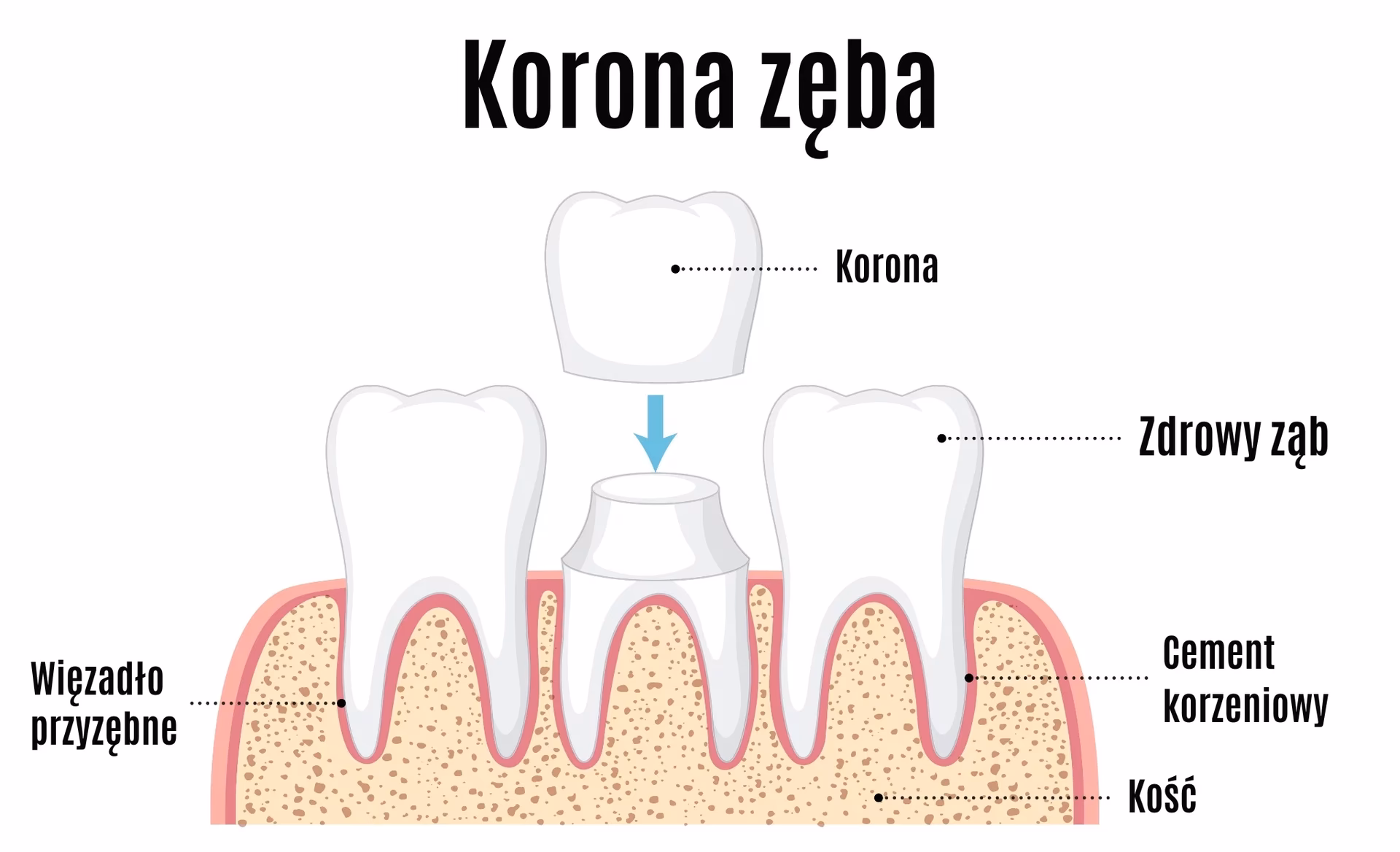 Ile kosztuje wypełnienie zęba w Krakowie?